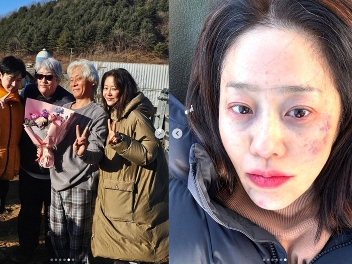 美人女優コ・ヒョンジョンがあざだらけの顔に(涙) 何があった? 実は……