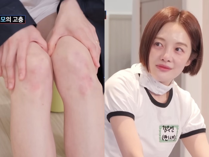 39歳で出産！『キム秘書』女優ファン・ボラ（41）、子育てで傷だらけになった膝に涙