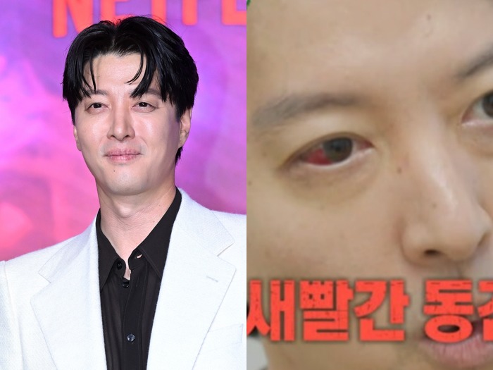 バツイチの『七日の王妃』俳優イ・ドンゴン、“人口1%の希少疾患”診断に衝撃。ファンから心配の声続々