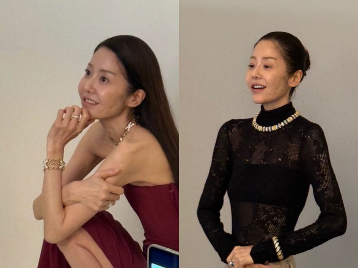 『善徳女王』女優コ・ヒョンジョン、“激ヤセ”の理由は後遺症!?「生死を彷徨った」闘病告白に再注目