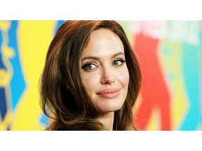 アンジェリーナ・ジョリー、レーザー治療で若々しい美顔をキープ 画像