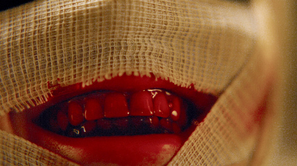 イビルアイ 10枚目の写真・画像