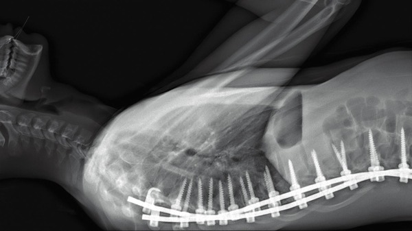 人体の構造について 3枚目の写真・画像