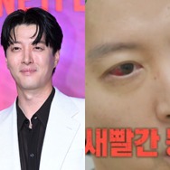 バツイチの『七日の王妃』俳優イ・ドンゴン、“人口1％の希少疾患”診断に衝撃。ファンから心配の声続々