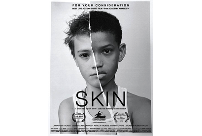 「Black Lives Matter」の高まり受け『SKIN』短編緊急配信 画像