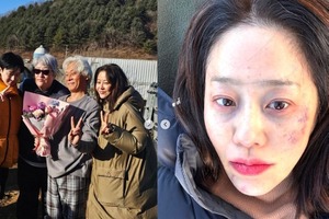 美人女優コ・ヒョンジョンがあざだらけの顔に(涙) 何があった?　実は…… 画像